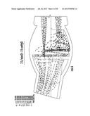 NEBULIZER THAT IS ACTIVATED BY NEGATIVE INSPIRATORY PRESSURE diagram and image