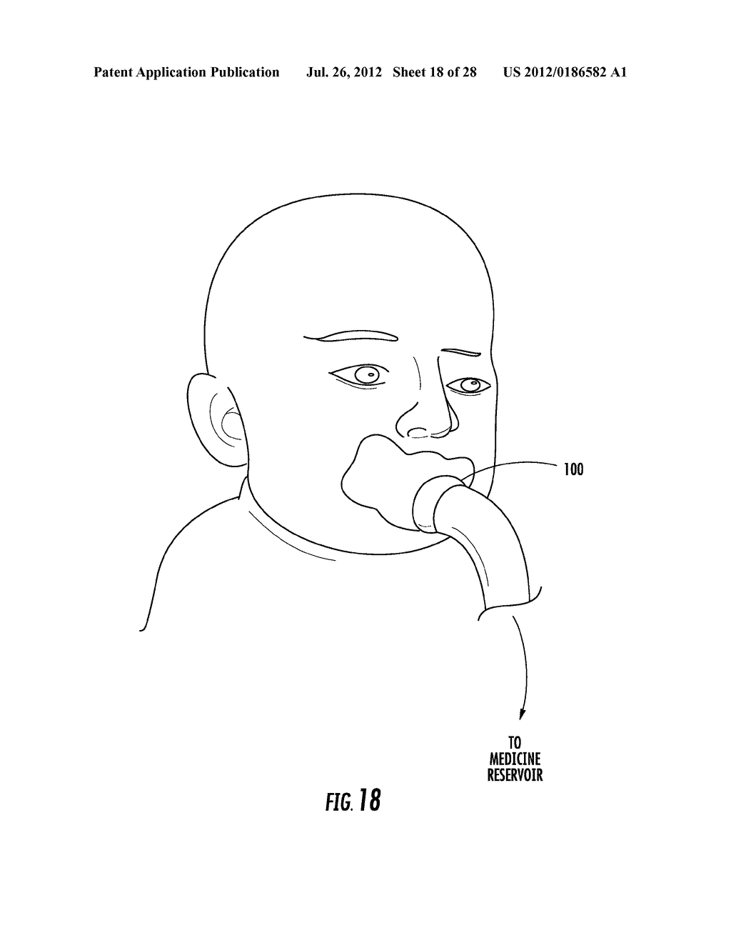 NEBULIZER THAT IS ACTIVATED BY NEGATIVE INSPIRATORY PRESSURE - diagram, schematic, and image 19