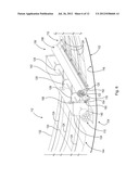 RUPTURE SEALING APPARATUS diagram and image