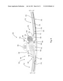 RUPTURE SEALING APPARATUS diagram and image