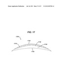 METHODS FOR FORMATION OF AN OPHTHALMIC LENS PRECURSOR AND LENS diagram and image