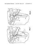 Clamp Mechanism For A Cover Assembly diagram and image