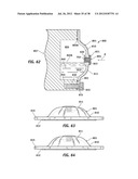 LUBRICATING OIL MONITORING AND MAINTENANCE CAPS FOR ROLLERS OF A TRACKED     VEHICLE diagram and image