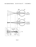 OPTIMIZING VISION CORRECTION PROCEDURES diagram and image