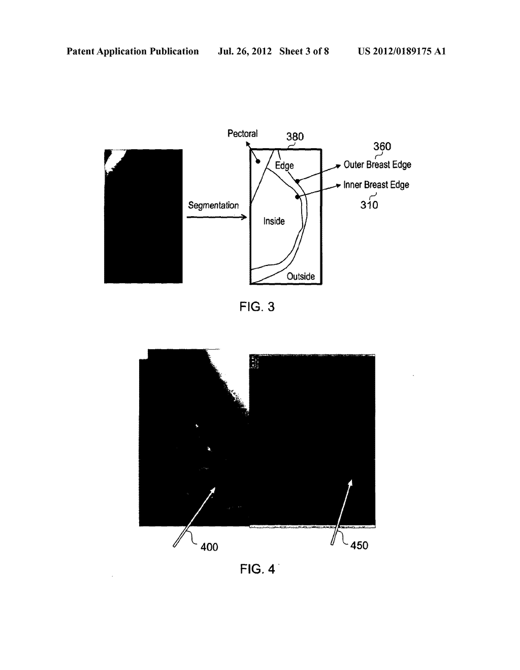 Method and system for analysing tissue from images - diagram, schematic, and image 04