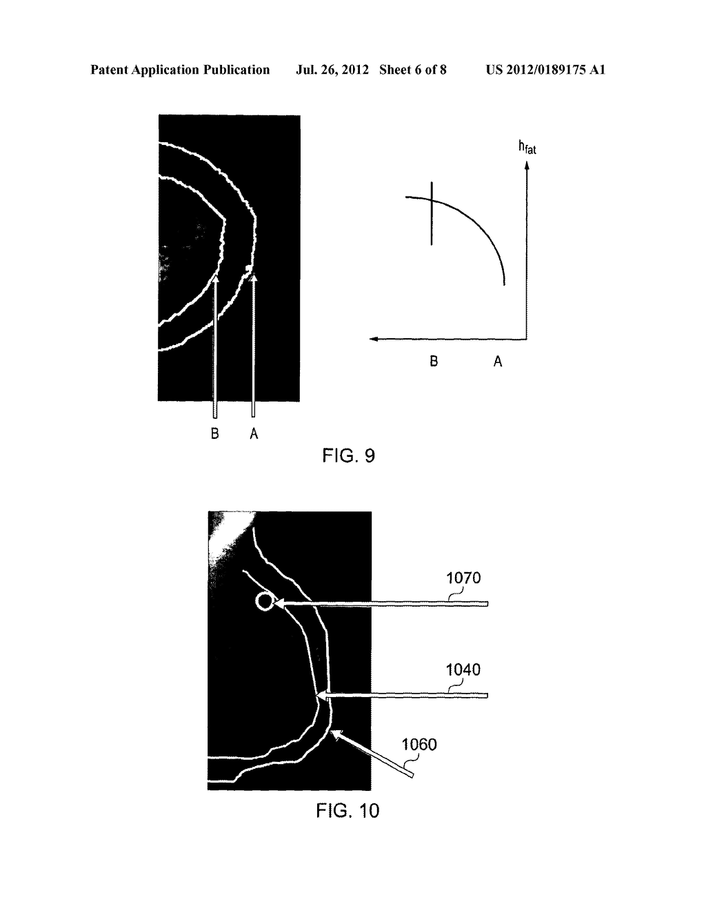 Method and system for analysing tissue from images - diagram, schematic, and image 07