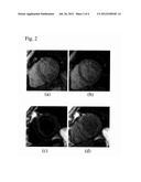 Automatic Registration of Image Series with Varying Contrast Based on     Synthetic Images Derived from Intensity Behavior Model diagram and image