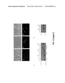 CROSS-  STRUCTURE COMPRISING AMYLOID-BINDING PROTEINS AND METHODS FOR     DETECTION OF THE CROSS-  STRUCTURE, FOR MODULATING CROSS-  STRUCTURES     FIBER FORMATION AND FOR MODULATING CROSS-  STRUCTURE-MEDIATED TOXICITY diagram and image