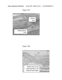 NOVEL INJECTABLE CHITOSAN MIXTURES FORMING HYDROGELS diagram and image