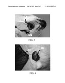 FLEXIBLE AND RIGID ENDOSCOPIC TRAINING DEVICE (FRED) diagram and image