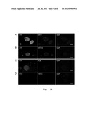 METHODS FOR OBTAINING HEPATOCYTES, HEPATIC ENDODERM CELLS AND HEPATIC     PROGENITOR CELLS BY INDUCED DIFFERENTIATION diagram and image