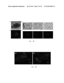 METHODS FOR OBTAINING HEPATOCYTES, HEPATIC ENDODERM CELLS AND HEPATIC     PROGENITOR CELLS BY INDUCED DIFFERENTIATION diagram and image