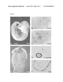 TREATMENT OF PATIENTS AFTER STENT IMPLANTATION OR BALLOON DILATATION AND     DRUG ELUTING STENTS diagram and image