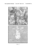 SELECTIVE INHIBITORS OF AKT AND METHODS OF USING SAME diagram and image