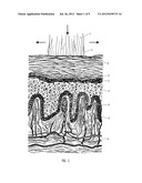 HIGHLY PENETRATING COMPOSITIONS AND METHODS FOR TREATING PATHOGEN-INDUCED     DISORDERED TISSUES diagram and image