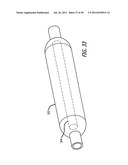 ASSEMBLY AND METHOD FOR AUTOMATICALLY CONTROLLING PRESSURE FOR A GASTRIC     BAND diagram and image