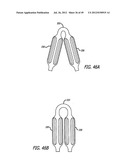 ASSEMBLY AND METHOD FOR AUTOMATICALLY CONTROLLING PRESSURE FOR A GASTRIC     BAND diagram and image