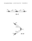 ASSEMBLY AND METHOD FOR AUTOMATICALLY CONTROLLING PRESSURE FOR A GASTRIC     BAND diagram and image