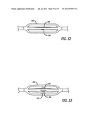 ASSEMBLY AND METHOD FOR AUTOMATICALLY CONTROLLING PRESSURE FOR A GASTRIC     BAND diagram and image