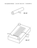 ASSEMBLY AND METHOD FOR AUTOMATICALLY CONTROLLING PRESSURE FOR A GASTRIC     BAND diagram and image