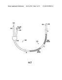 SYSTEM AND METHOD OF DIAGNOSING ACID REFLUX USING INVOLUNTARY REFLEX COUGH     TEST diagram and image