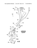 SYSTEM AND METHOD OF DIAGNOSING ACID REFLUX USING INVOLUNTARY REFLEX COUGH     TEST diagram and image