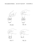 Medical Device Inserters and Processes of Inserting and Using Medical     Devices diagram and image