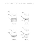 Medical Device Inserters and Processes of Inserting and Using Medical     Devices diagram and image