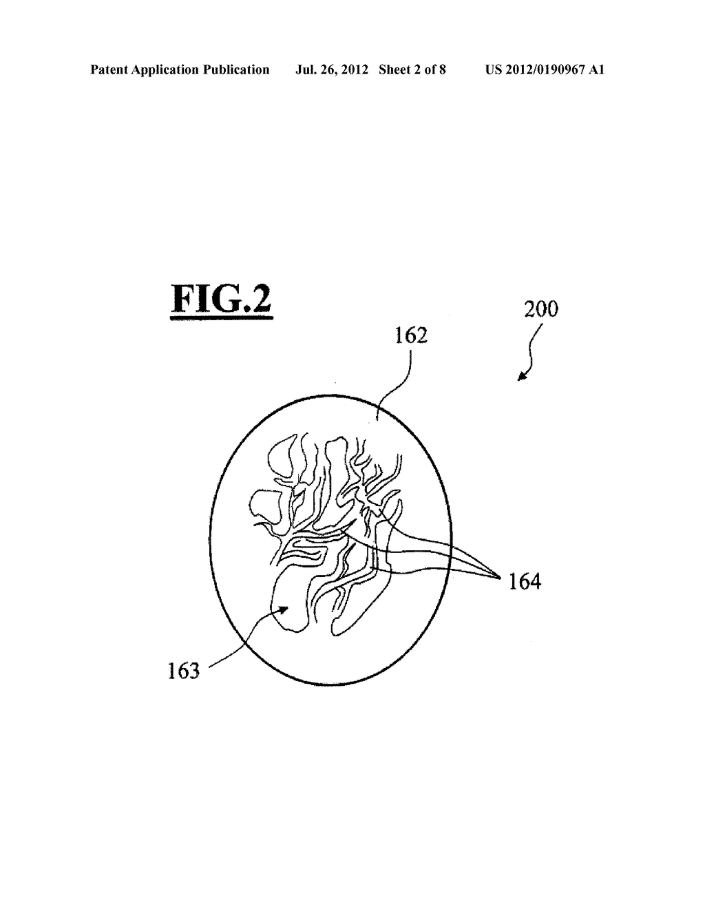 ARRANGEMENT AND METHOD FOR QUANTITATIVELY DETERMINING THE BLOOD FLOW     WITHIN BLOOD VESSELS - diagram, schematic, and image 03