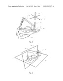 NAVIGATION SYSTEM FOR ORTHOPAEDIC SURGERY diagram and image