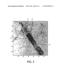 DEPTH DISAMBIGUATION OF INTERVENTIONAL INSTRUMENTS FROM A SINGLE X-RAY     PROJECTION IMAGE AND ITS CALIBRATION diagram and image