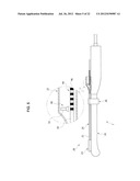 TREATMENT DEVICE diagram and image