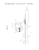 TREATMENT DEVICE diagram and image