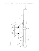 TREATMENT DEVICE diagram and image