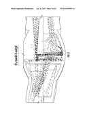 PEDIATRIC NEBULIZER diagram and image