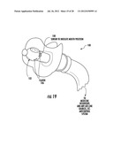 PEDIATRIC NEBULIZER diagram and image