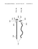 Controllable Stiffness Guidewire diagram and image