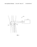 METHOD AND DEVICE FOR TREATING OSTEOARTHRITIS NONINVASIVELY diagram and image