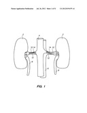 System and method for endoluminal and translumenal therapy diagram and image