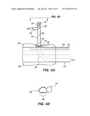 System and method for endoluminal and translumenal therapy diagram and image