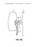 System and method for endoluminal and translumenal therapy diagram and image