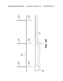 System and method for endoluminal and translumenal therapy diagram and image