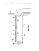 System and method for endoluminal and translumenal therapy diagram and image