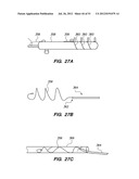 System and method for endoluminal and translumenal therapy diagram and image