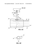 System and method for endoluminal and translumenal therapy diagram and image