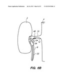 System and method for endoluminal and translumenal therapy diagram and image