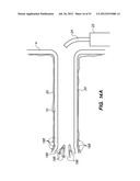 System and method for endoluminal and translumenal therapy diagram and image