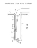 System and method for endoluminal and translumenal therapy diagram and image