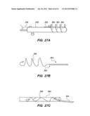 System and method for endoluminal and translumenal therapy diagram and image