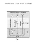 Apparatus and Methods for Titrating Arrhythmia Therapy Based on Spectral     Mapping During Sinus Rhythm diagram and image